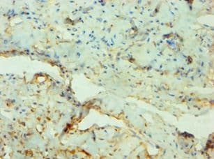 Polyclonal Rabbit anti-Human SGK3 Antibody (aa1-150, IHC)