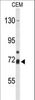 Polyclonal Rabbit anti-Human ALOX15B / 15-LOX-2 Antibody (aa597-627, IHC, WB)