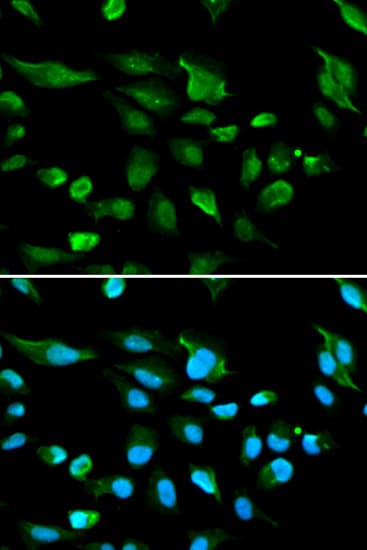 IHC-plus™ Polyclonal Rabbit anti-Human AIRE Antibody (IHC, IF, WB)