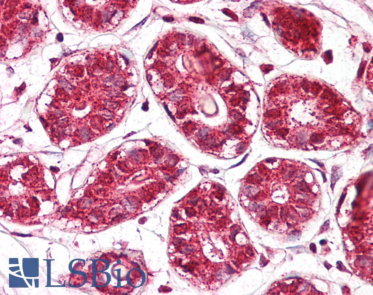 Polyclonal Rabbit anti-Human JMJD6 / PSR Antibody (aa214-263, IHC, WB)