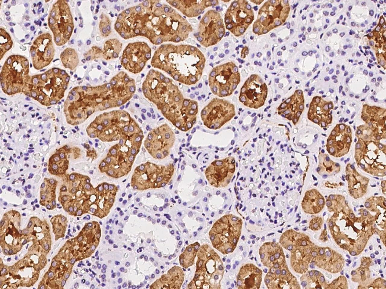 FTCD / 58K Golgi Protein Antibody