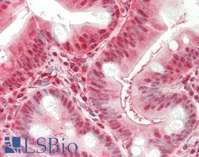IHC-plus™ Monoclonal Mouse anti-Human GAPDH Antibody (clone ABM22C5, aa120-320, IHC, WB)