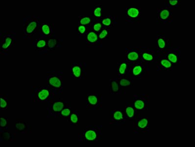 Polyclonal Rabbit anti-Human HIST1H3A Antibody (IHC, IF)