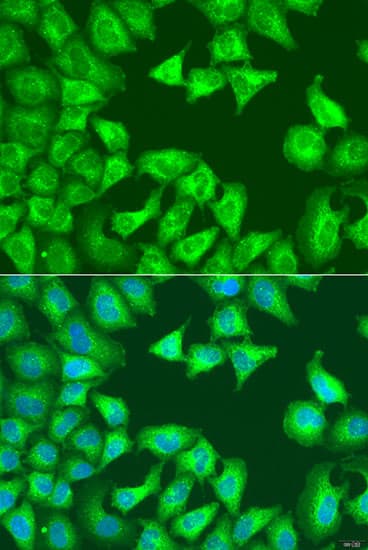 SQSTM1 Antibody