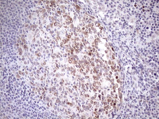 Monoclonal Mouse anti-Human AAAS / Adracalin Antibody (clone OTI5B10, aa322-546, IHC, WB)