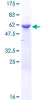 Human HNRNPC / HNRNP C Protein (Recombinant GST)