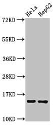 Polyclonal Rabbit anti-Human Fragilis / IFITM3 Antibody (IHC, WB)