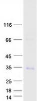 Human TRAT1 / TRIM Protein (Recombinant Myc-DDK (Flag))