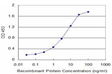 SLC1A2 / EAAT2 / GLT-1 Antibody (clone 1D8)