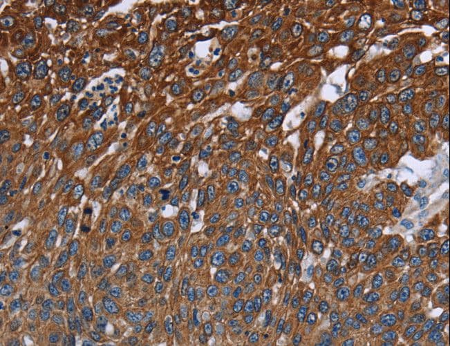 Polyclonal Rabbit anti-Human FCGR3A / CD16A Antibody (IHC)