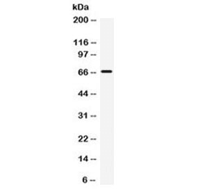 Polyclonal Rabbit anti-Human ST7 Antibody (WB)