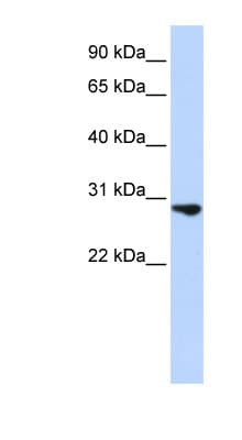 FGF2 / Basic FGF Antibody (C-Terminus)