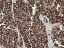 CXorf26 Antibody (clone OTI5A11)