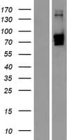 Human CPXM1 / CPXM Protein (Over-Expression Lysate Myc-DDK (Flag))