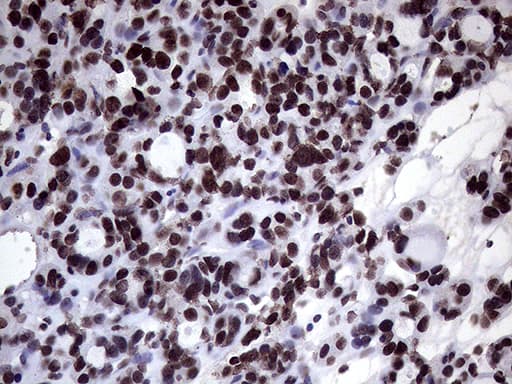 XRN2 Antibody (aa677-779, clone OTI5F4)