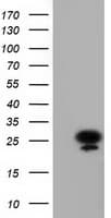 AK3 / Adenylate Kinase 3 Antibody (clone OTI6B7, Carrier-free)