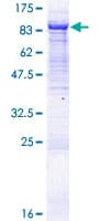 Human VPS33B Protein (Recombinant GST)