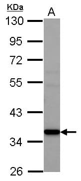 AMD / AMD1 Antibody