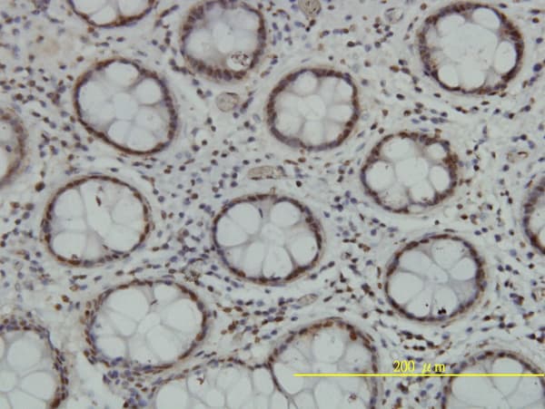 Monoclonal Mouse anti-Human TLK2 Antibody (clone 2G7, IHC, IF, WB)