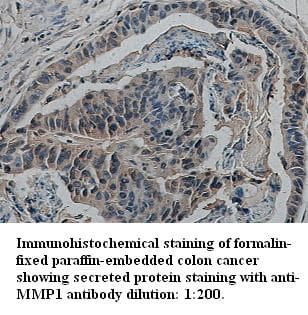 MMP1 Antibody (Internal)