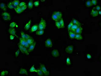 Polyclonal Rabbit anti-Human SCARA5 Antibody (IHC, IF)