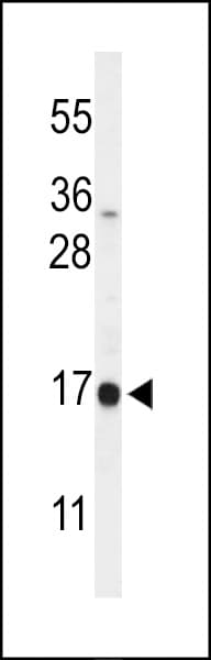 Polyclonal Rabbit anti-Human DAZAP2 Antibody (aa111-139, IHC, WB)