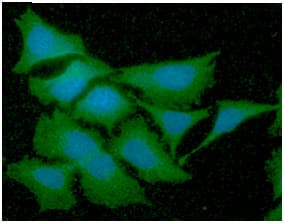 GSTT2 Antibody (clone AT10H4)
