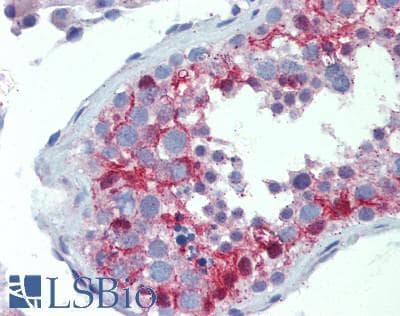 IHC-plus™ SLCO1A2 / OATP Antibody