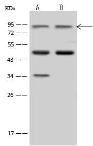 Polyclonal Rabbit anti-Human ZW10 Antibody (IF, WB)