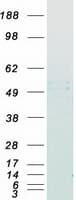 Human FNTB Protein (Recombinant Myc-DDK (Flag))