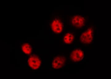 LIMK1 / LIMK Antibody (phospho-Thr508)