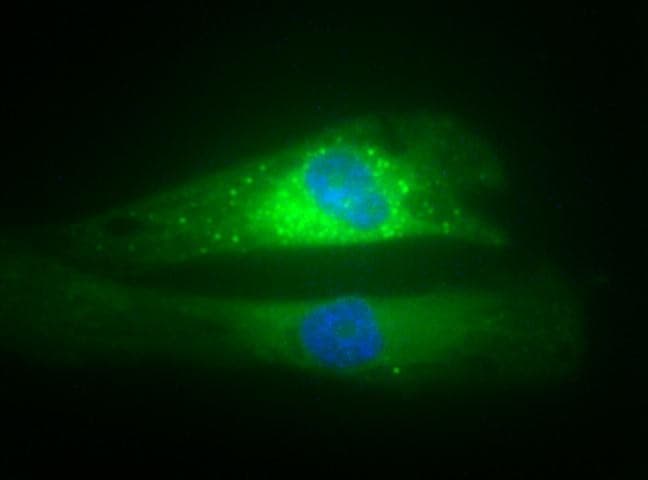 SQSTM1 Antibody