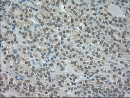 CTAG1B / NY-ESO-1 Antibody (clone OTI2B6)