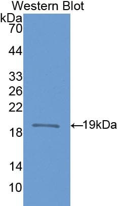 NOS1 / nNOS Antibody (aa468-616)