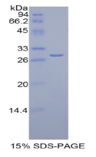 Human EZH2 Protein (Recombinant 6His, N-terminus)