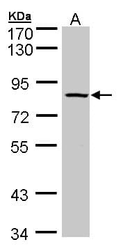 IHC-plus™ Polyclonal Rabbit anti-Human ADAM33 Antibody (IHC, WB)