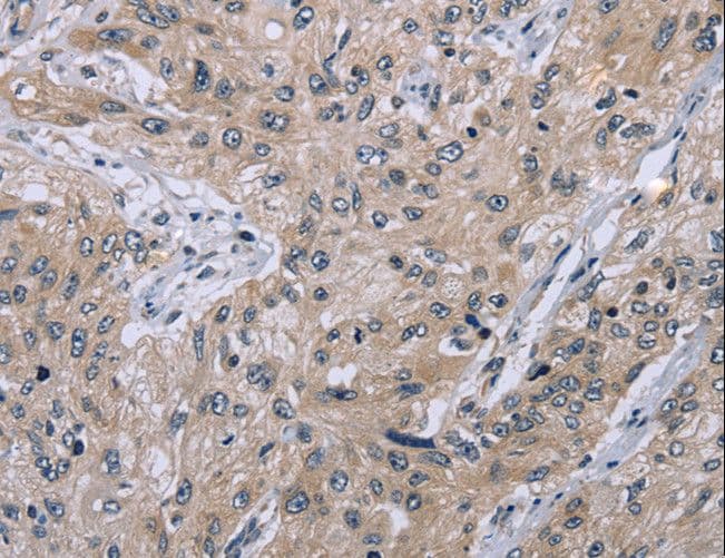 EID1 / EID-1 Antibody
