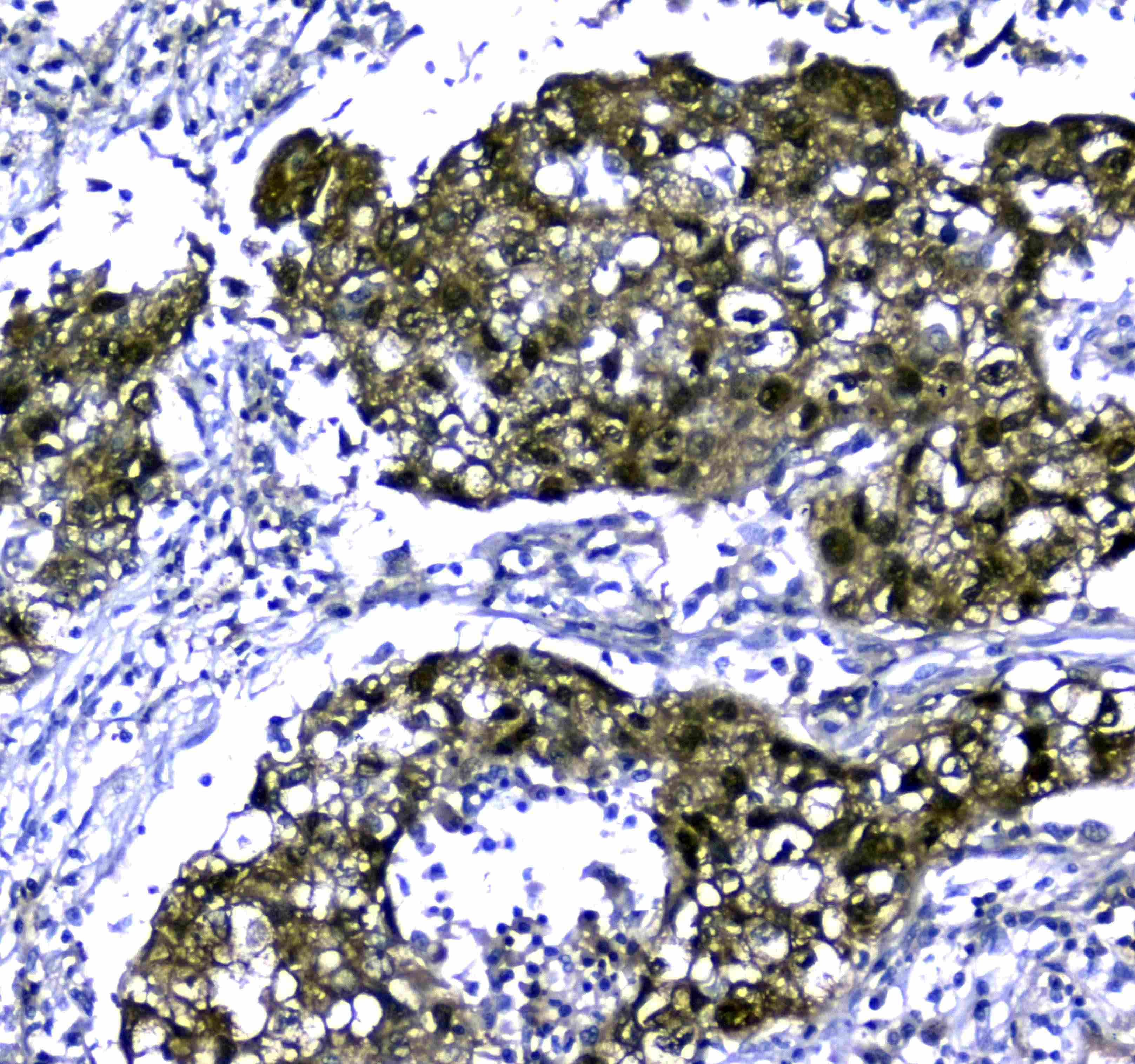 Polyclonal Rabbit anti-Human STUB1 / CHIP Antibody (IHC, WB)
