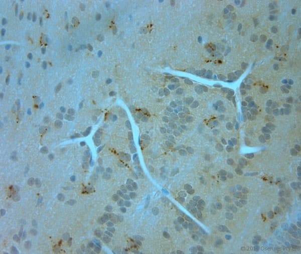 Polyclonal Rabbit anti-Human ITPR1 / IP3 Receptor Type 1 Antibody (aa700-750, IHC)