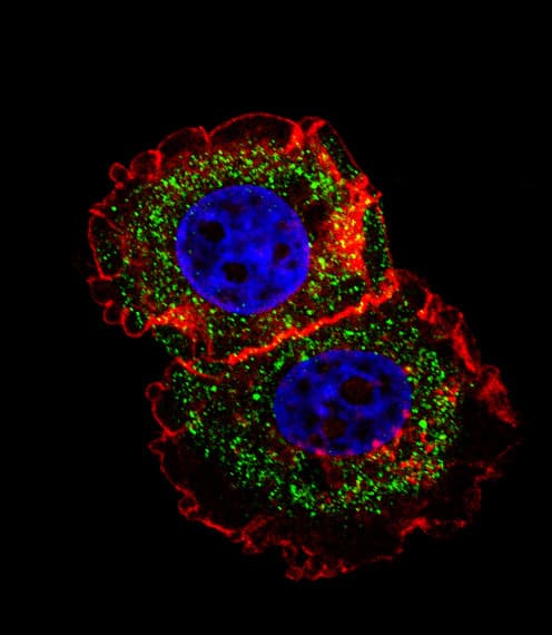 ER Alpha / Estrogen Receptor Antibody (aa452-480)