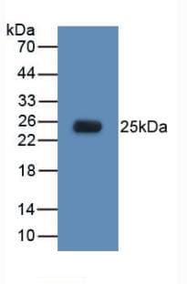 TLR5 Antibody (aa46-205)
