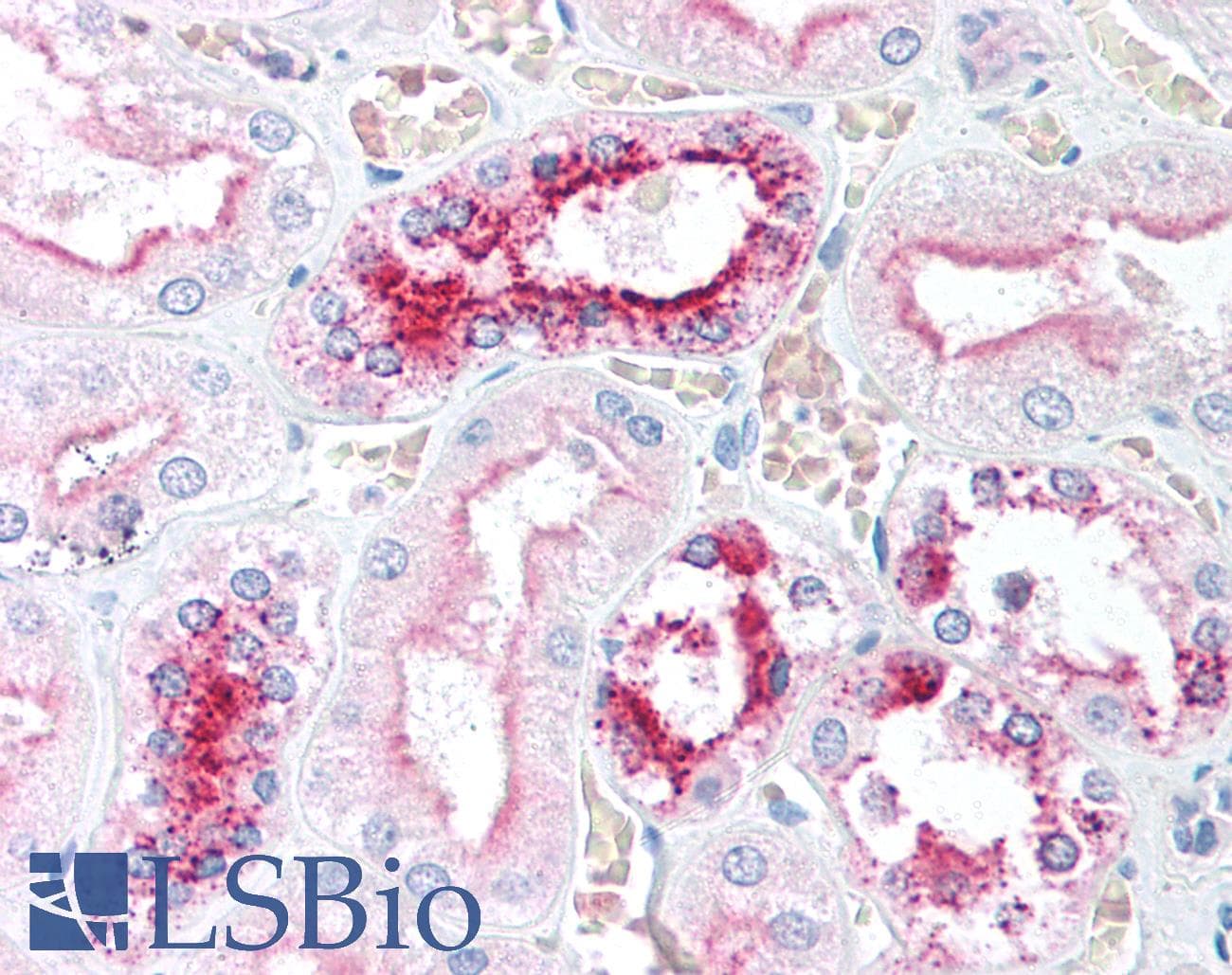 IHC-plus™ p16INK4a / CDKN2A Antibody