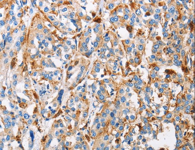 Polyclonal Rabbit anti-Human CTSL / Cathepsin L Antibody (IHC)