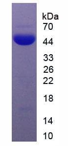 Human AMH / Anti-Mullerian Hormone Protein (Recombinant His, N-Terminal)