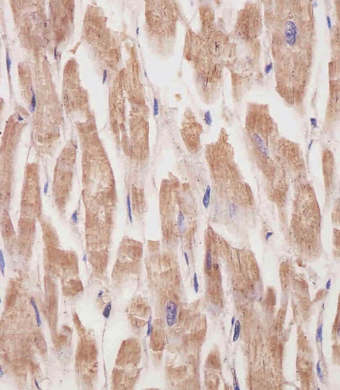 KANK1 Antibody (clone 1773CT634.49.61)