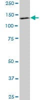 PDGFRB / PDGFR Beta Antibody (clone 4C12)