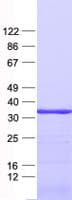 Human UNG / Uracil DNA Glycosylase Protein (Recombinant His, N-Terminal)