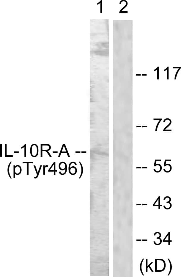 Polyclonal Rabbit anti-Human IL10RA Antibody (phospho-Tyr496, WB)