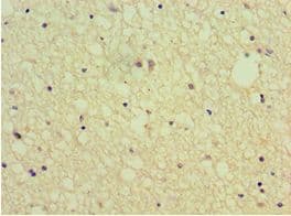 SEMA4C / Semaphorin 4C Antibody (aa749-833)