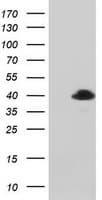 MAGEB1 Antibody (clone OTI2B12)